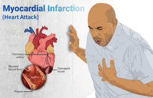 image of a heart and person having a heart attack