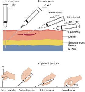 different types of injections