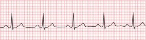 ECG record