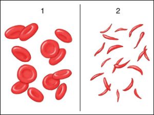 Red blood cells and sickle cells