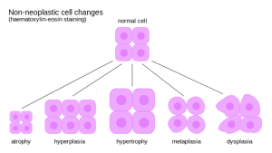 illustrates several of these using the suffixes -trophy ("nourishment" or "development") and -plasia ("formation").