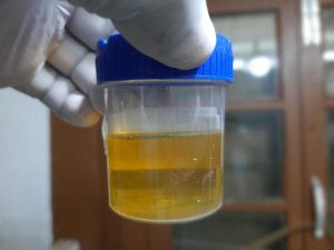 urine in sample container