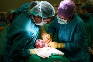 c-section being performed