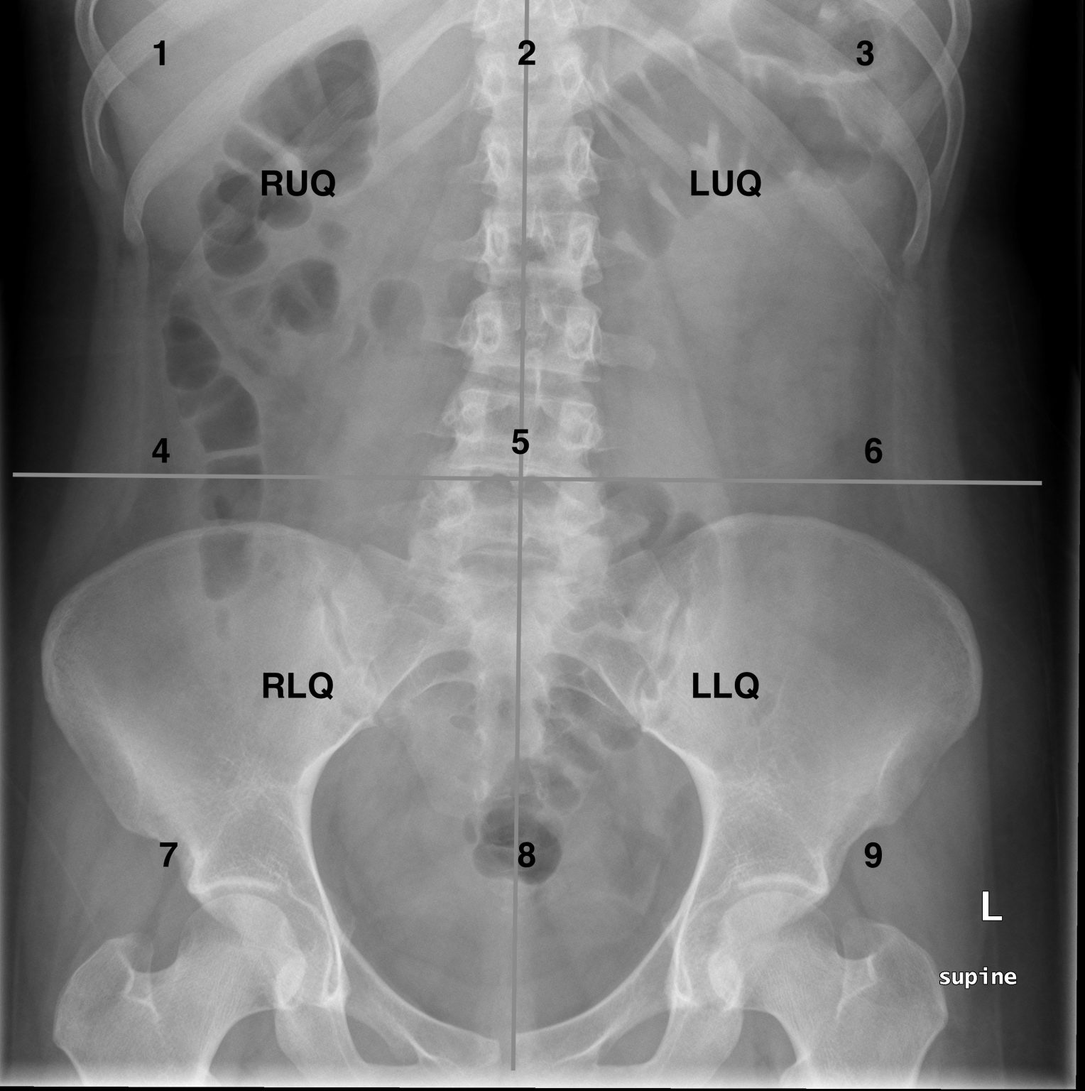 8.5 Diagnostic Imaging: Example Scans – The Language of Medical Terminology