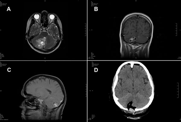 planes with MRI