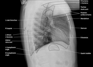 chest x-ray