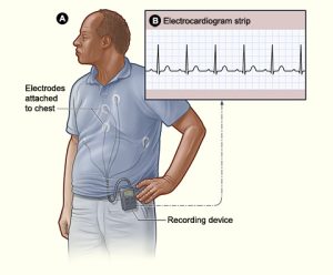 Holter monitor