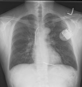 chest x-ray