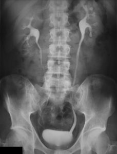 Urography image