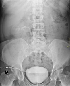 Urography image