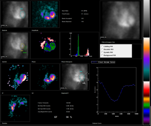 MUGA scan images