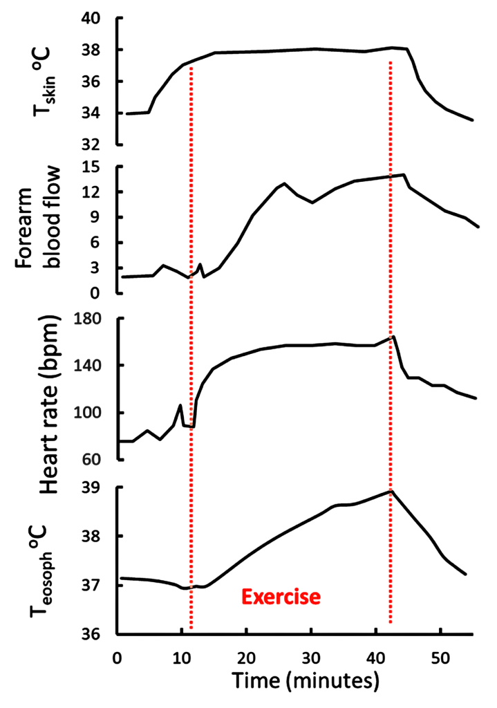 This figure is well explained in the text. It illustrates the changes in heart rate and forearm blood flow and core temperature, indicated by esophageal temperature when exercise is added to warmed skin. Skin was warmed by wearing a water circulated vest that increased skiin temperature to 38 degrees. Esophageal temperature increased from 37 degrees to nearly 39 degrees after just 30 min of mild exercise.