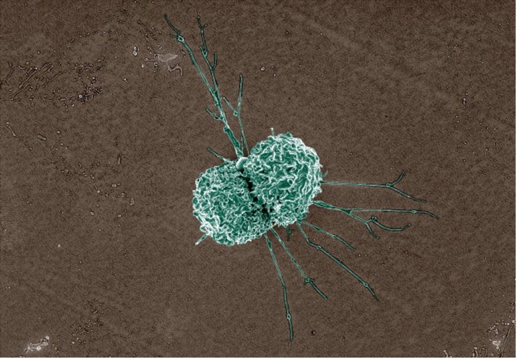 a microscopic image of a dendritic macrophage. the background is brown and the dendritic macrophage is green, with white highlights. It appears to be dividing in two and has a number of long thin spikes protruding from it.