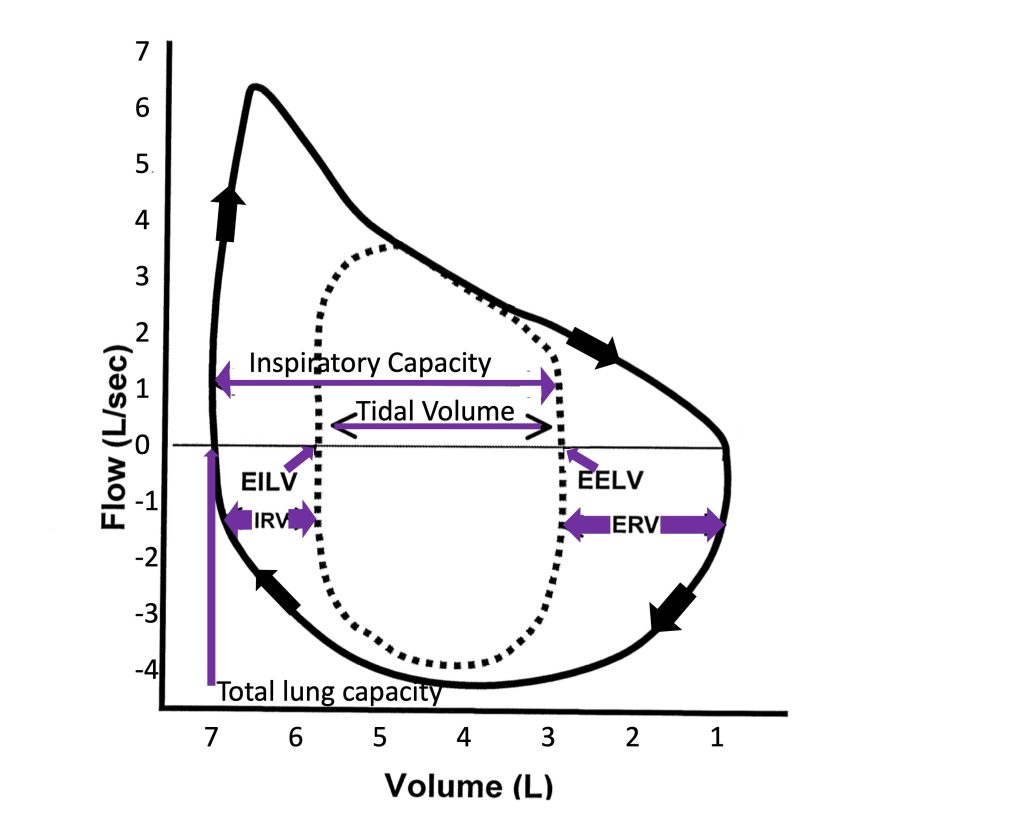 This image shows the relationship between flow and volume of the lungs during an inspiration/exhalation during maximal exercise and during a forced exhalation following a maximal inspiration. It is important to note that the volume is zero on the right and 7 litres on the left. The combined inhalation/exhalation during maximal exercise kind of looks like a race-track with a short-cut at one end, cutting off the bend. During maximal exercise, inspiration begins with about 3 litres of air in the lungs and flow increases rapidly to about 4 L/s then declines quickly to zero after a tidal volume of about 2.5 L. Breathing out from this level reaches a peak flow of about 3.5 L/s, which is pretty close to or equal to the flow at that volume during the forced exhalation. This is the short-cut at one end of the race track. The sides of the race-track are at 3 Litres and 5.5 Litres and peak inspiratory flow is similar to peak expiratory flow. When a maximal inhalation occurs, the lungs are filled to total lung capacity, here about 7 Litres. Now when the person blows out forcefully as hard and fast as they can, outward flow increases rapidly to just over 6 Litres/s. Then flow rapidly falls as lung volume decreases from 6.5 Litres to 5 Litres, then the rate of decrease slows until as much air as possible has been exhaled. About 1 Litre of air is still in the lungs. This is the residual volume.