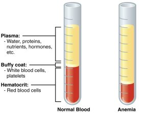 anemia blood tube