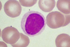 lymphocyte