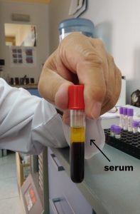 serum blood tube