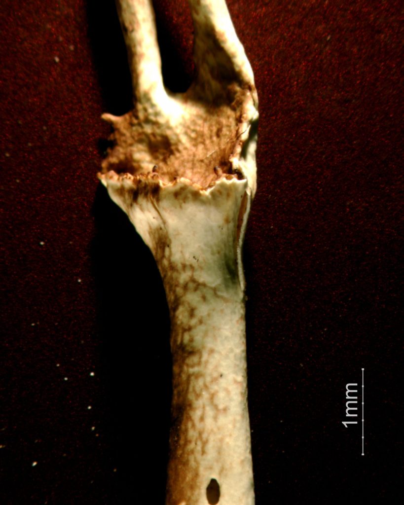 Cladonia gracilis subsp. turbinata