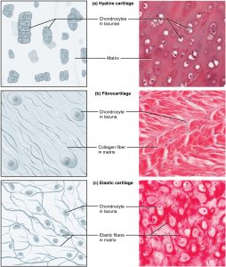 Image of three types of cartilage